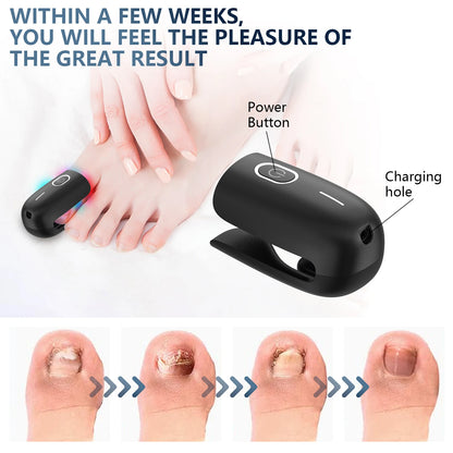 Nail Fungus Cleaning Device