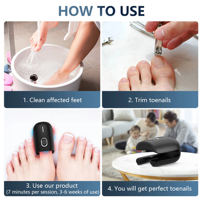 Nail Fungus Cleaning Device