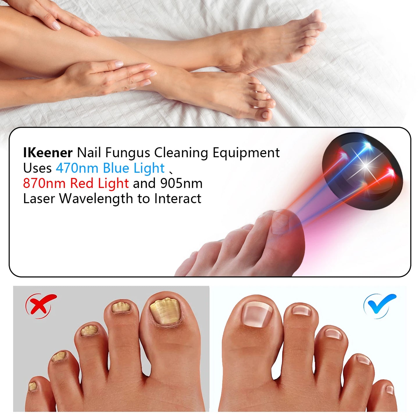 Nail Fungus Cleaning Device