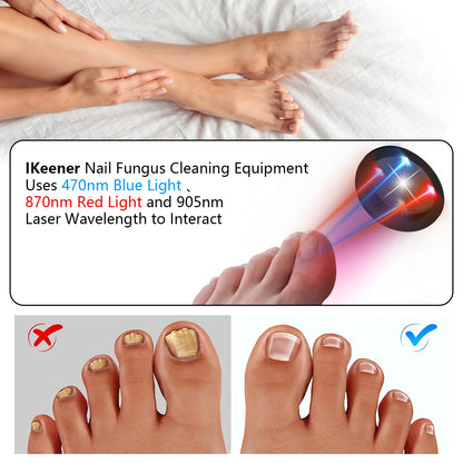 Nail Fungus Cleaning Device